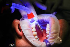 dentist15